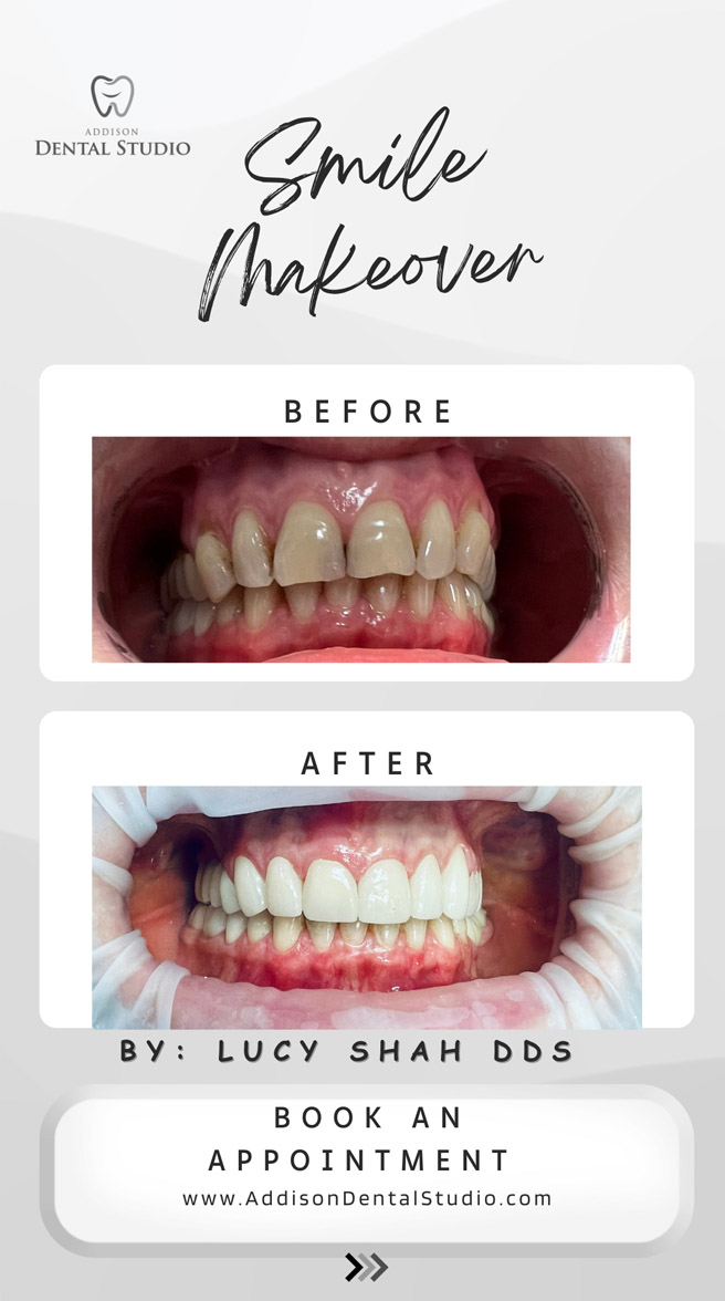 Addison Dental Studio | Dermal Fillers, Root Canals and Dentures