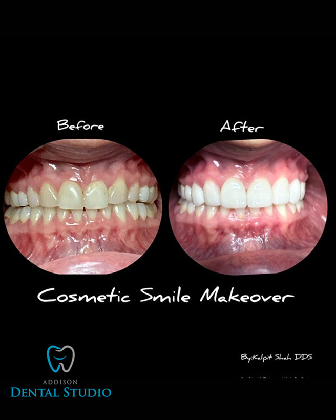 Addison Dental Studio | Laser Dentistry, Periodontal Treatment and CBCT