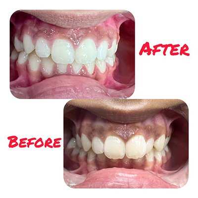 Addison Dental Studio | Ceramic Crowns, Veneers and All-on-4 reg 